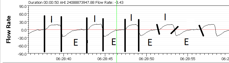 Normal respiration markup.png